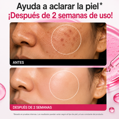 ANUA NIACINAMIDE SERUM - Renueva tu belleza en pocos días