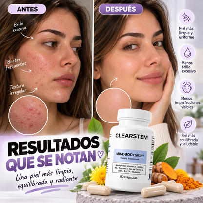 MINDBODYSKIN  - Arranca el Acné de Raíz y Recupera tu confianza