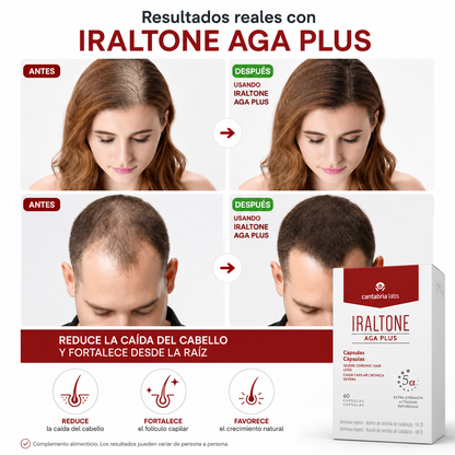 Iraltone - Recupera tu cabello en solo semanas